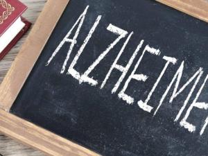 alzheimer's.2