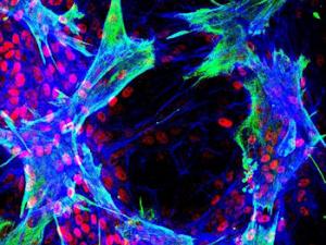 Imagen de inmunofluorescencia que muestra células estrelladas hepáticas primarias humanas que interactúan con células progenitoras hepáticas bipotentes in vitro. Los cultivos se marcaron utilizando anticuerpos contra vimentina (verde), HNF4a (rojo) y se trataron con faloidina (azul). El estudio mostró que la diferenciación de las células progenitoras se localizó en los sitios de contacto entre los dos tipos de células. / CIBERDEM