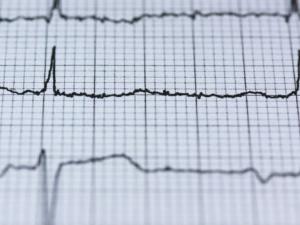 El "electrocardiograma" del estómago. / stux (PIXABAY)