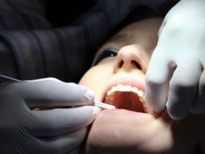 La infección del corazón que empieza en el dentista. / rgerber (PIXABAY)