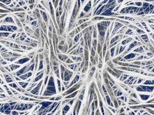 Neuronas 